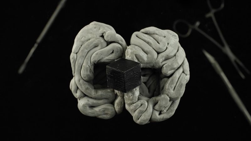 Grey Matter