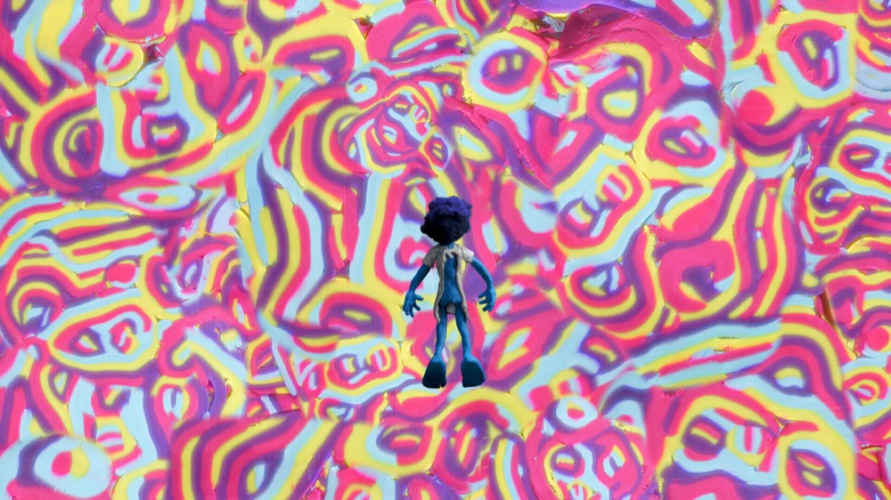 MRI — still 1